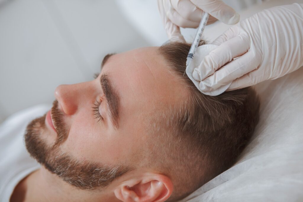PRP Treatment in Hyderabad | 