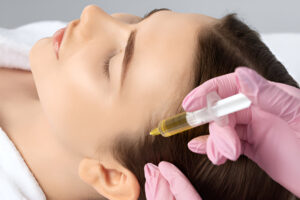 Hair loss treatment in Hyderabad & Hair Regrowth Clinics
